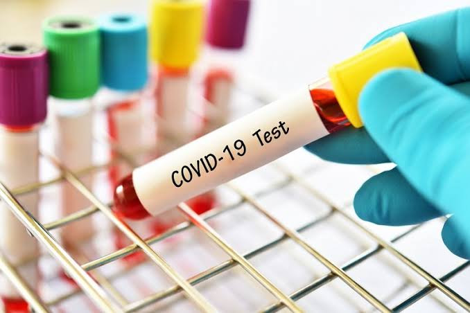 RI Berpotensi Ciptakan Varian Covid-19 Jenis Baru, Ini Penjelasannya (FOTO: MNC Media)