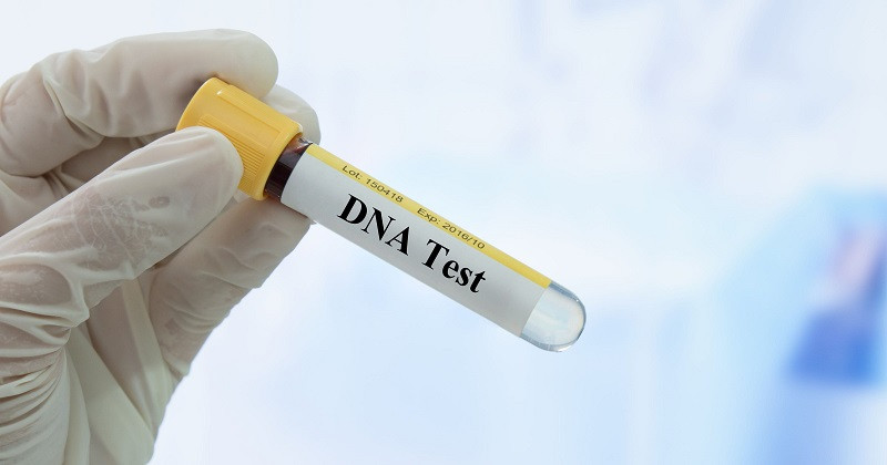 Mau Tahu Garis Keturunan? Ini Biaya Tes DNA di Rumah Sakit. (Foto: MNC Media)