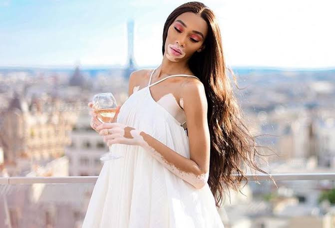 Cerita Sukses Winnie Harlow, Model Cantik Dunia yang Miliki 