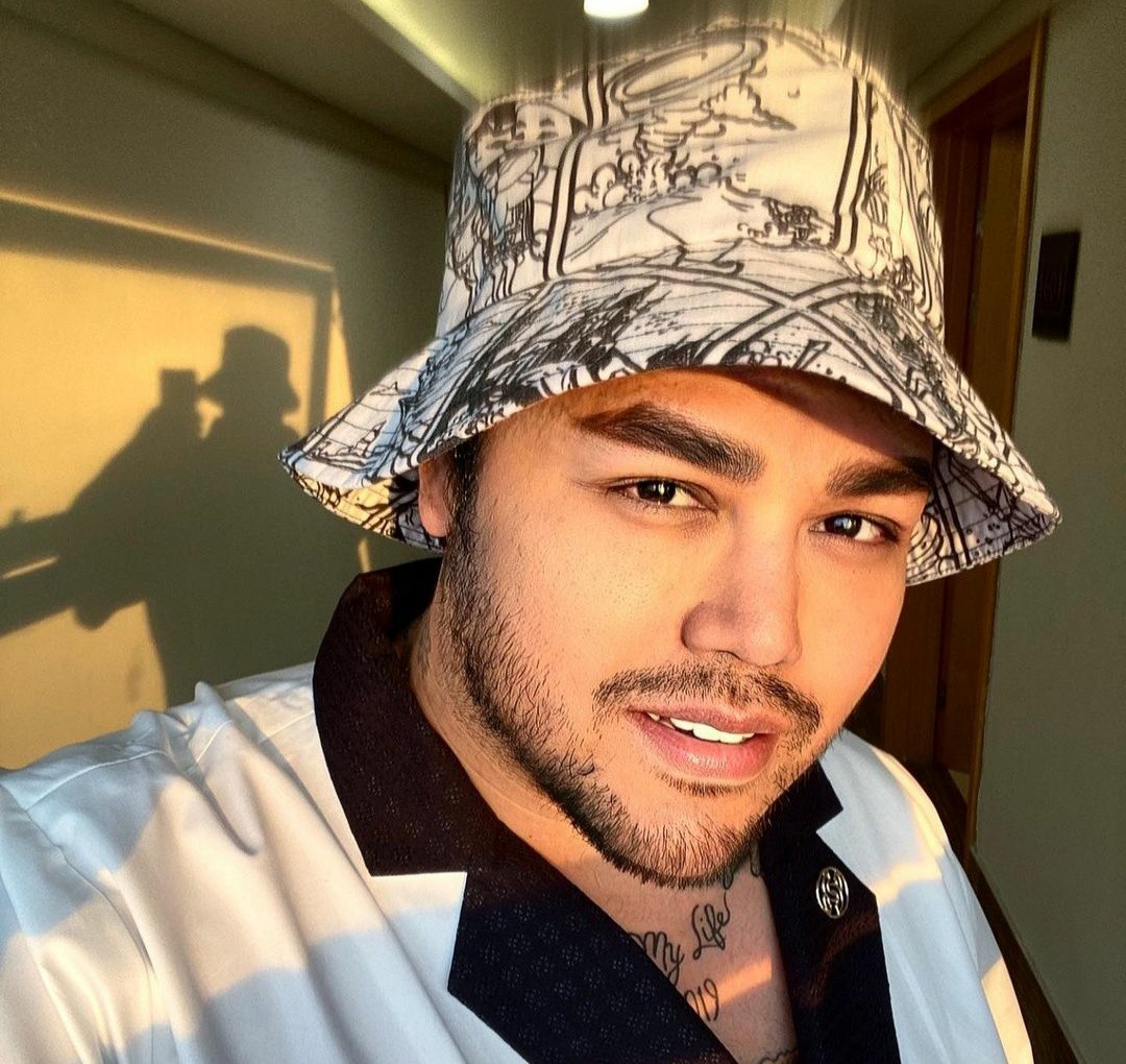 Ivan Gunawan unggah foto pipi tirus. (Foto: Instagram Ivan Gunawan)