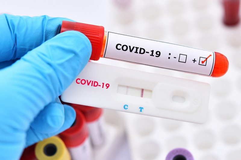 Ilustrasi Rapid Test Covid-19