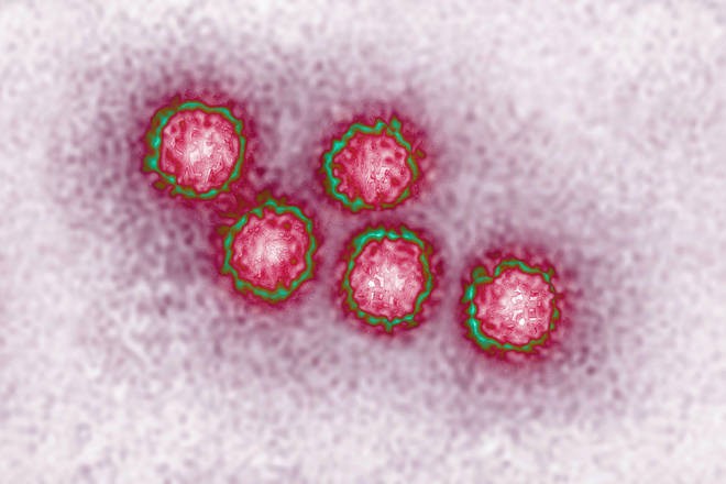 Enam Anak Meninggal Diduga Akibat Hepatitis Misterius