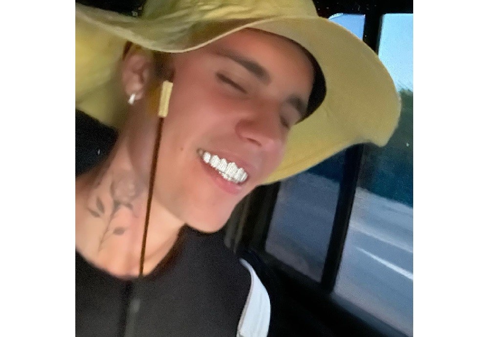 Justin Bieber Pamerkan Gigi Berlian Senilai Ratusan Juta Rupiah