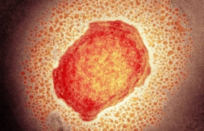 Tiga Warga Tertular Virus Cacar Monyet, Belgia Terapkan Karantina 21 Hari (FOTO:MNC Media)