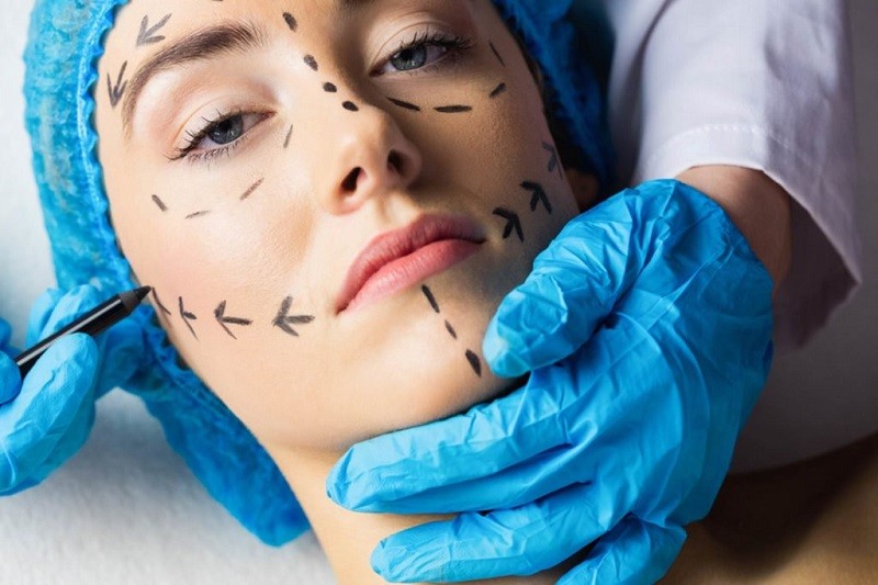Intip Biaya Operasi Anti Aging di Indonesia dan Korea Selatan, Termahal Tembus Rp200 Juta. (Foto: MNC Media)