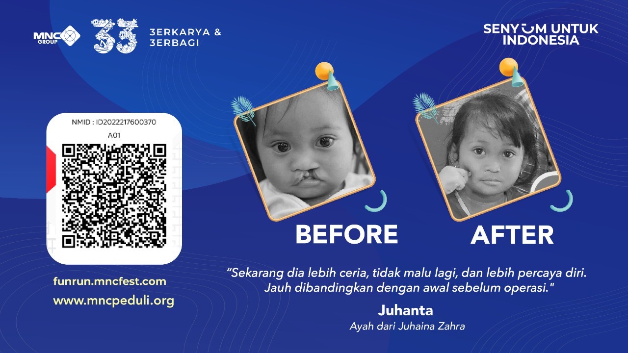 Bantu Mengukir Senyum Anak Indonesia dengan Ikut MNC Fun Charity Run, Yuk! Foto: MNC Media.
