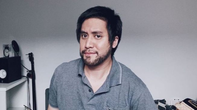 Musisi Kevin Aprilio sempat menghebohkan publik dengan penampilan terbarunya, pasca melakukan transplantasi rambut.