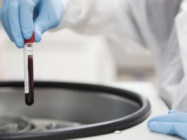 Kanker Leukimia Paling Tinggi di Indonesia, Begini Pencegahannya (Foto: MNC Media)