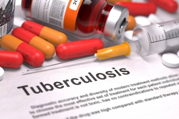 Indonesia Targetkan Eliminasi Tuberkulosis di 2030, Tekan Kasus hingga 90 Persen. (Foto: MNC Media)