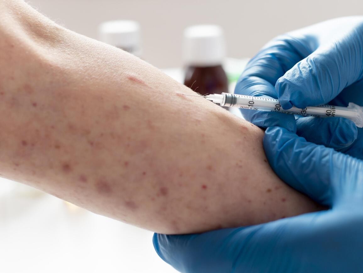 Antisipasi Penularan, Kemenkes Percepat Imunisasi Kejar Campak-Rubella Jelang Libur Lebaran 2026. (Foto: Istimewa)