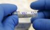 Dunia Waspada! Virus Zika Bisa Jadi Pandemi Usai Covid-19. (Foto: MNC Media)