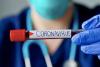 Epidemiologi Sebut Pengendalian Covid-19 di RI Semakin Terkendali