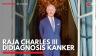 Raja Charles III Didiagnosis Kanker. (Sumber : IDXChanne)