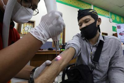 Peserta mengikuti pengahpusan tato secara gratis di Jakarta Islamic Centre (JIC), Jakarta, Selasa (20/4/2021).