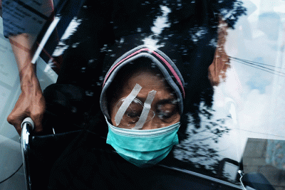 Sejumlah warga tengah menjalani operasi mata katarak di JEC Orbita (Celebes Eye Center), Jalan AP Pettarani, Makassar, Minggu (6/3/2022).