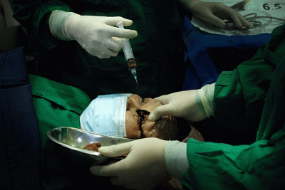 Sejumlah warga tengah menjalani operasi mata katarak di JEC Orbita (Celebes Eye Center), Jalan AP Pettarani, Makassar, Minggu (6/3/2022).