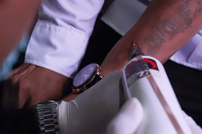 Petugas menghapus tinta tato dengan menggunakan laser saat kegiatan hapus tato gratis di Kantor Sekretariat DPP Forum Ulama Habaib (Fuhab), Jakarta Selatan.