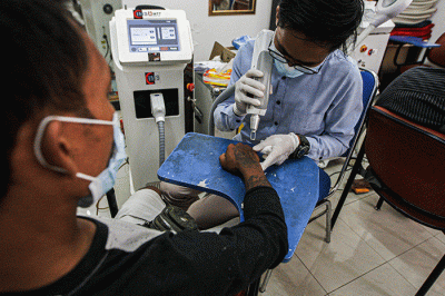 Peserta menghapus tato saat kegiatan roadshow hapus tato di Masjid Al Fauz, Kompleks Kantor Wali Kota Jakarta Pusat, Selasa (26/4/2022).