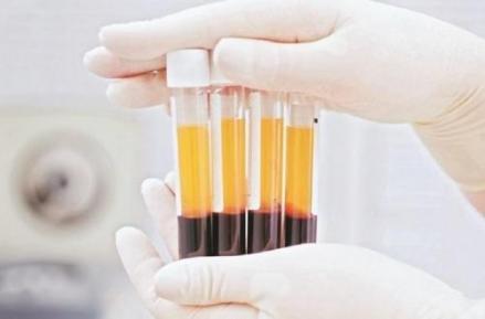 Terapi Plasma Konvalesen Cegah Hospitalisasi hingga 50 Persen. (Foto Ilustrasi: MNC Media)
