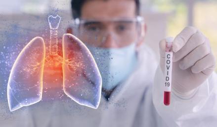 Kasus konfirmasi positif Covid-19 di Indonesia pada Minggu, 10 April 2022 bertambah 1.071 kasus.
