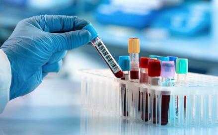 Perkembangan hepatitis akut misterius di Indonesia hingga hari ini terus bertambah menjadi 70 kasus di 21 Provinsi.