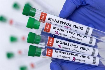 Vaksin dan Antivirus Cacar Monyet Masih Tahap Penelitian, Penggunaannya Terbatas. (Foto: MNC Media)