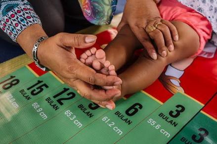 Ini Dua Penyebab Angka Stunting di RI Tinggi, Kemiskinan Termasuk? (Foto MNC Media)