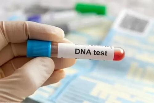 Berapa Biaya Tes DNA? Cek Kisarannya