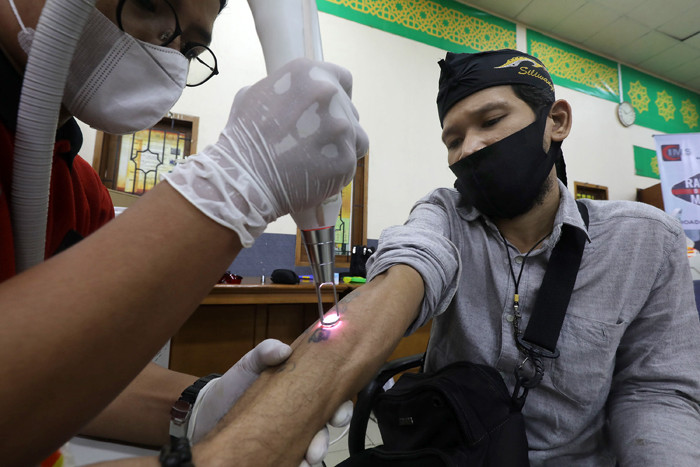 Peserta mengikuti pengahpusan tato secara gratis di Jakarta Islamic Centre (JIC), Jakarta, Selasa (20/4/2021).