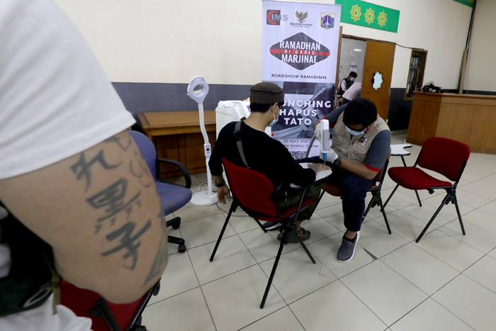 Peserta mengikuti pengahpusan tato secara gratis di Jakarta Islamic Centre (JIC), Jakarta, Selasa (20/4/2021).