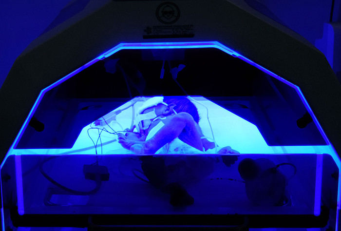 Tenaga Kesehatan tengah melakukan penanganan lanjutan pada bayi baru lahir di ruang neonatal intensive care unit Rumah Sakit Tajuddin Chalid, Jumat (9/7/2021).