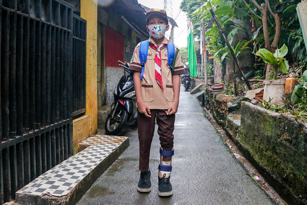 Rizki (9) dibantu ibunya Euis Paridah (40) saat mengenakan sepatu khusus di kediamannya di kawasan Menteng Dalam, Jakarta Selatan, Jumat (5/11/2021).