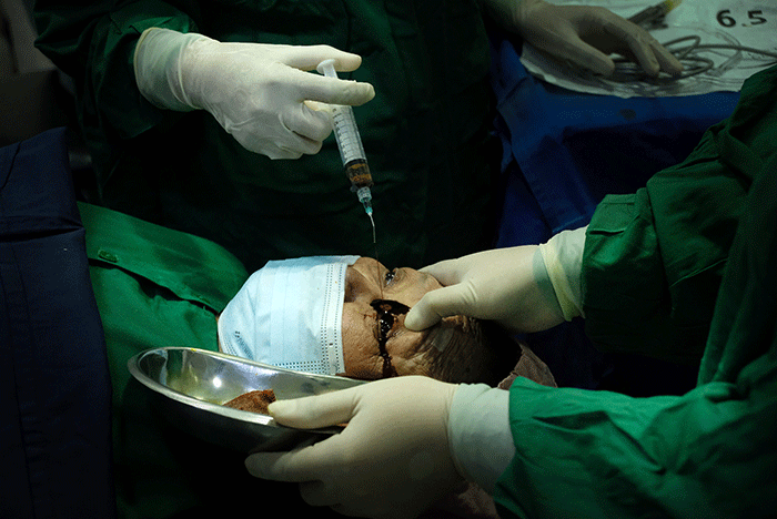 Sejumlah warga tengah menjalani operasi mata katarak di JEC Orbita (Celebes Eye Center), Jalan AP Pettarani, Makassar, Minggu (6/3/2022).