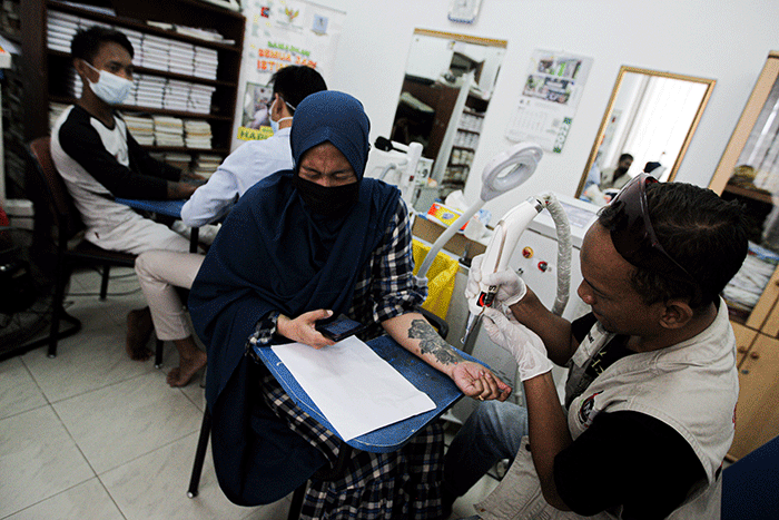Peserta menghapus tato saat kegiatan roadshow hapus tato di Masjid Al Fauz, Kompleks Kantor Wali Kota Jakarta Pusat, Selasa (26/4/2022).