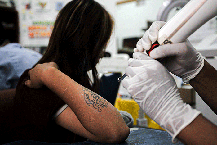 Peserta menghapus tato saat kegiatan roadshow hapus tato di Masjid Al Fauz, Kompleks Kantor Wali Kota Jakarta Pusat, Selasa (26/4/2022).