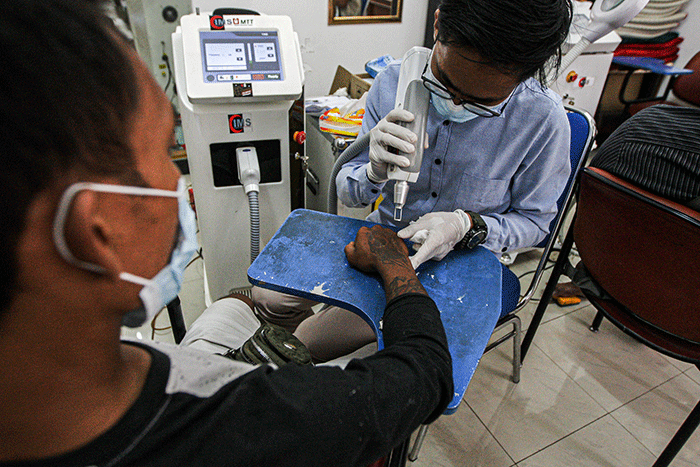 Peserta menghapus tato saat kegiatan roadshow hapus tato di Masjid Al Fauz, Kompleks Kantor Wali Kota Jakarta Pusat, Selasa (26/4/2022).