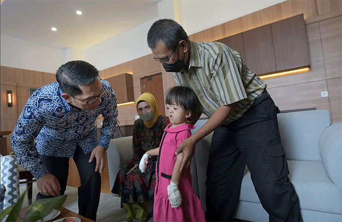 Gubernur Jawa Barat Ridwan Kamil memberikan bantuan kemanusiaan kepada Arini Supriatna (4), balita pengidap penyakit apert syndrome.