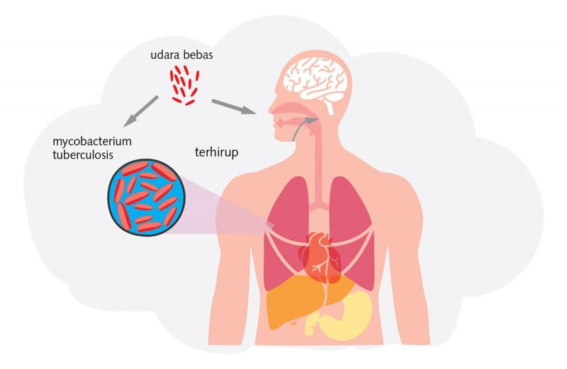 Indonesia Jadi Penyumbang TBC Terbesar Kedua di Dunia Setelah India